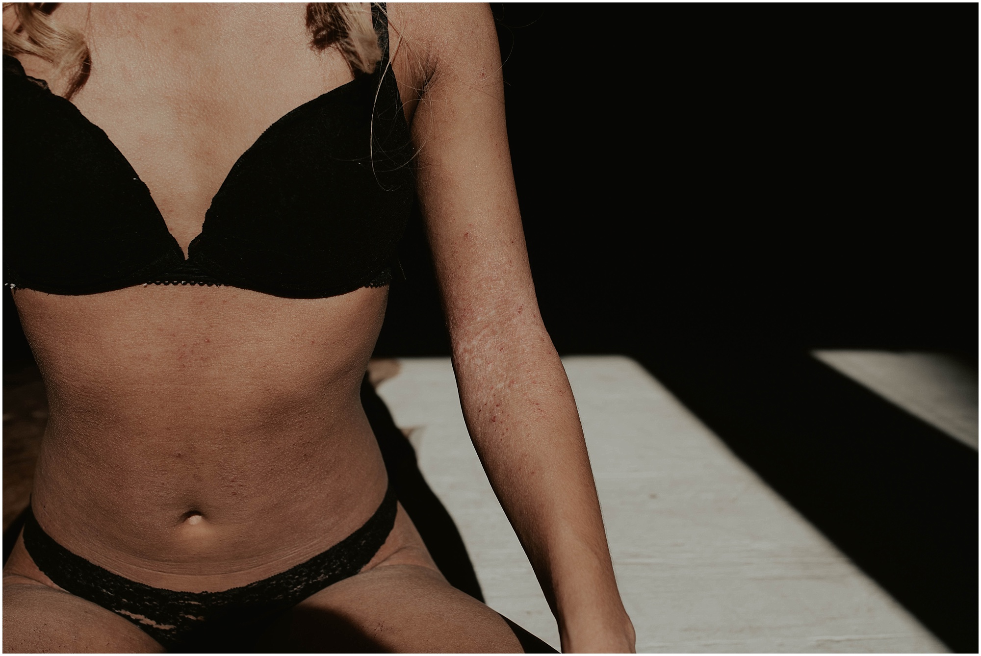 seattle, seattle-boudoir, seattle-boudoir-photographer, Impossible-boudoir-project, boudoir-photos, pioneer-square-boudoir, boudoir-photography, boudoir-inspiration, female-empowerment, Eczema, Eczema-boudoir, Empowered, boudoir-project,