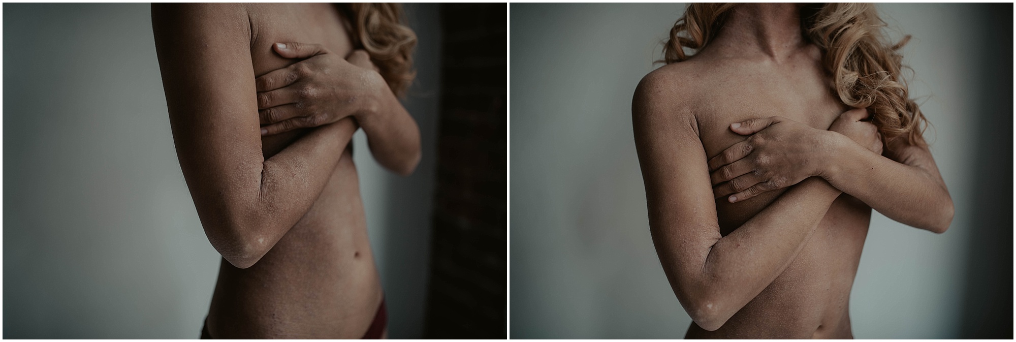 seattle, seattle-boudoir, seattle-boudoir-photographer, Impossible-boudoir-project, boudoir-photos, pioneer-square-boudoir, boudoir-photography, boudoir-inspiration, female-empowerment, Eczema, Eczema-boudoir, Empowered, boudoir-project,