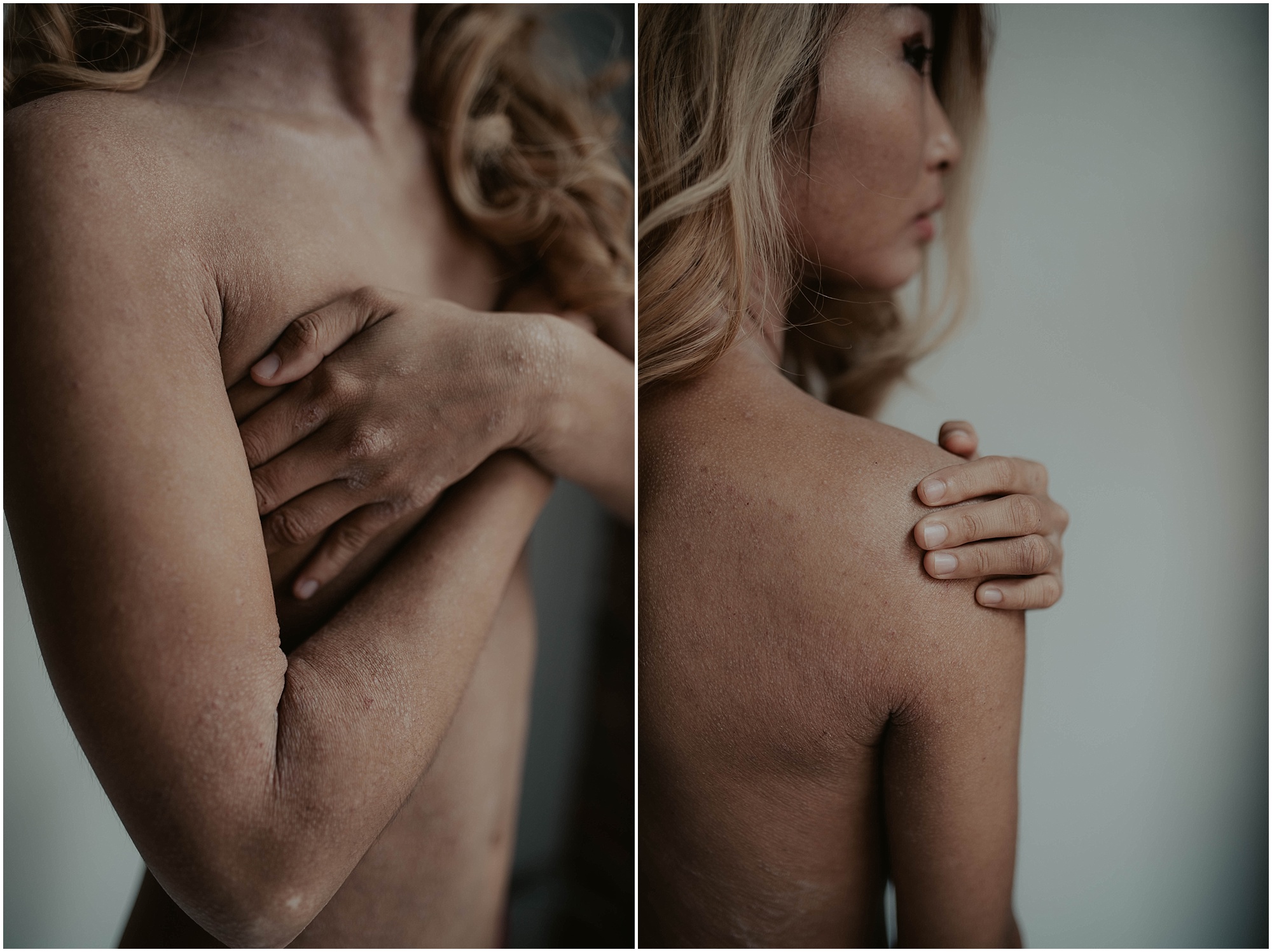 seattle, seattle-boudoir, seattle-boudoir-photographer, Impossible-boudoir-project, boudoir-photos, pioneer-square-boudoir, boudoir-photography, boudoir-inspiration, female-empowerment, Eczema, Eczema-boudoir, Empowered, boudoir-project,