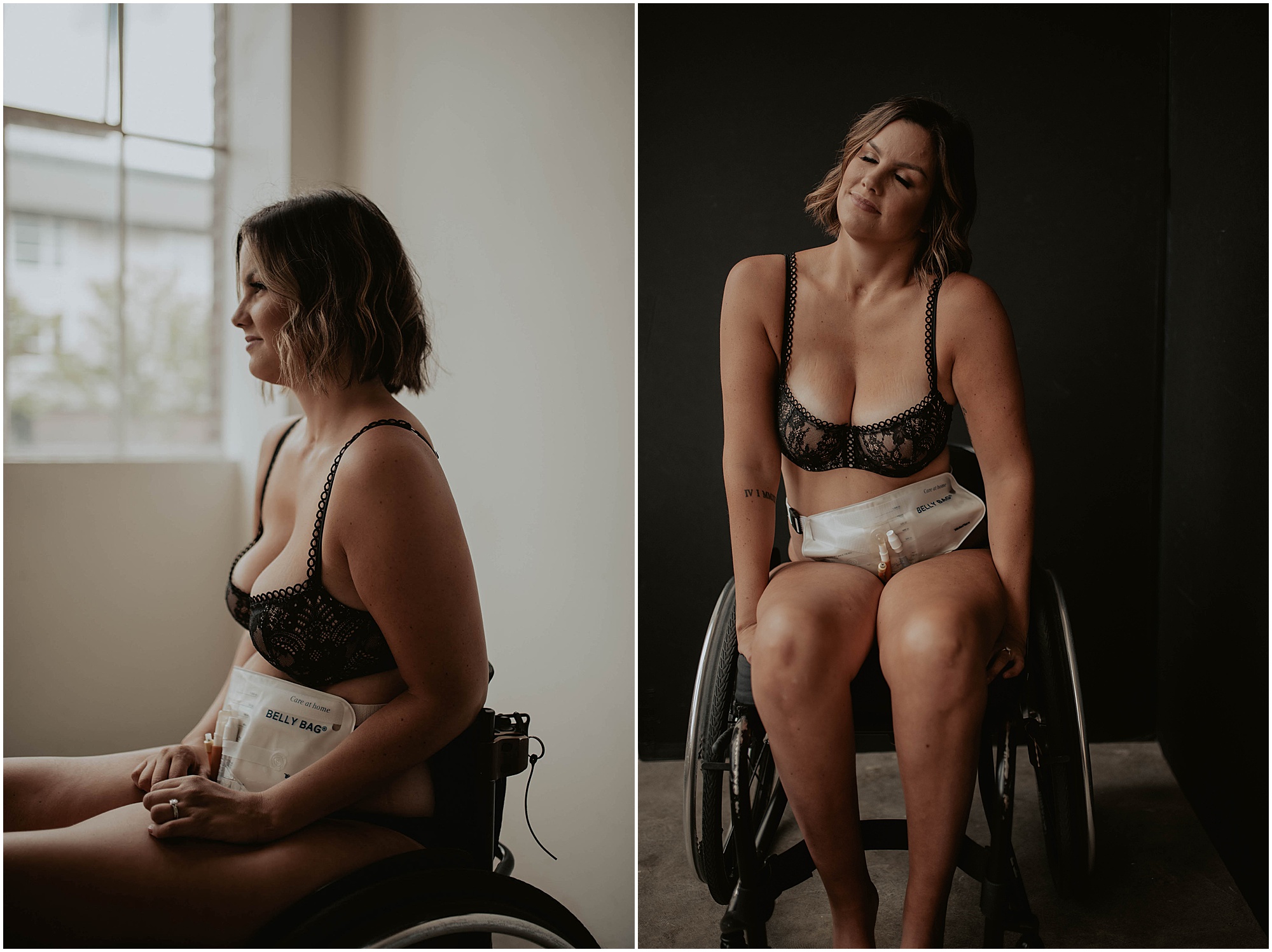 Paralyzed-Boudoir-Project, Paralyzed-Photos, Paralyzed-Photography-Project, Paralyzed-Boudoir-Session, Wheelchair-Boudoir-Photos, seattle, seattle-boudoir, seattle-boudoir-photographer, paralyzed-boudoir-photos, paralyzed-boudoir, paralyzed, boudoir-photography, boudoir-inspiration, female-empowerment, body-positive-project, impossible-boudoir-project, Empowered, boudoir-project, body-love-boudoir, Wheelchair, Wheelchair-Boudoir, Belly-Bag-Boudoir, Belly-Bag,